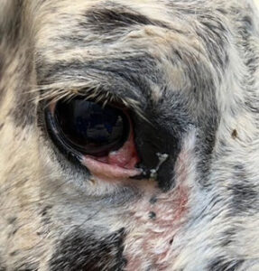 Carcinome épidermoide oculaire