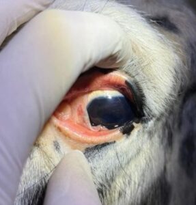 Carcinome épidermoide oculaire